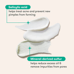 Proactive Gentle 3 step Acne Routine Kit Simple KojicLux