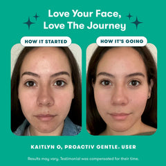 Proactive Gentle 3 step Acne Routine Kit Simple KojicLux