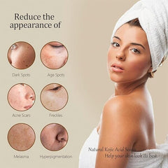 KojicLux: Lemon Turmeric Kojic Soap Bars (3pk) Simple Showcase