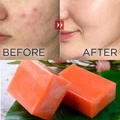 Kojic Acid Soap Bars (3pk) Simple Showcase