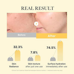 KojicLux Kojic & Turmeric Face Mask (4 Pack) Simple Exclusive