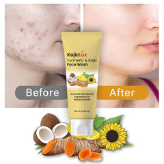 KojicLux Kojic Acid & Turmeric Face Wash Facial Cleanser (250mL) Simple Exclusive