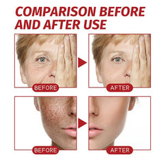 KojicLux Kojic Acid Facial Cream (50g) Simple Exclusive