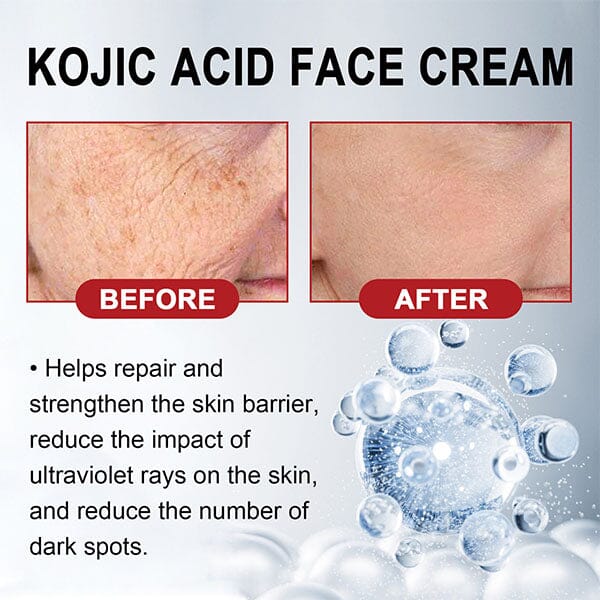 KojicLux Kojic Acid Facial Cream (50g) Simple Exclusive