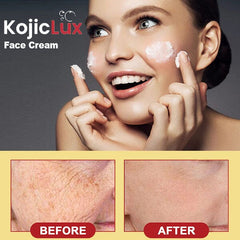 KojicLux Kojic Acid Facial Cream (50g) Simple Exclusive