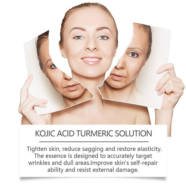 KojicLux Kojic Acid & Turmeric Root Facial Serum (30mL) Simple Exclusive