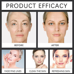 KojicLux Kojic Acid & Turmeric Root Facial Serum (30mL) Simple Exclusive