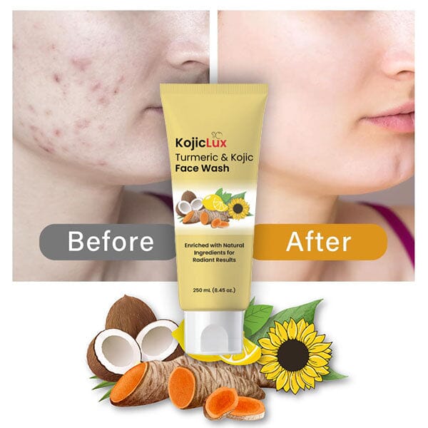 KojicLux Kojic Acid & Turmeric Face Wash Facial Cleanser (250mL) Simple Exclusive 